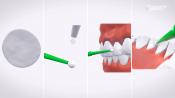 Samodzielne leczenie nadwrażliwych zębów  – czy to w ogóle możliwe?